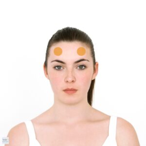 Mental Stress Release Technique - Girl with 2 circles on her head showing the frontal eminences.